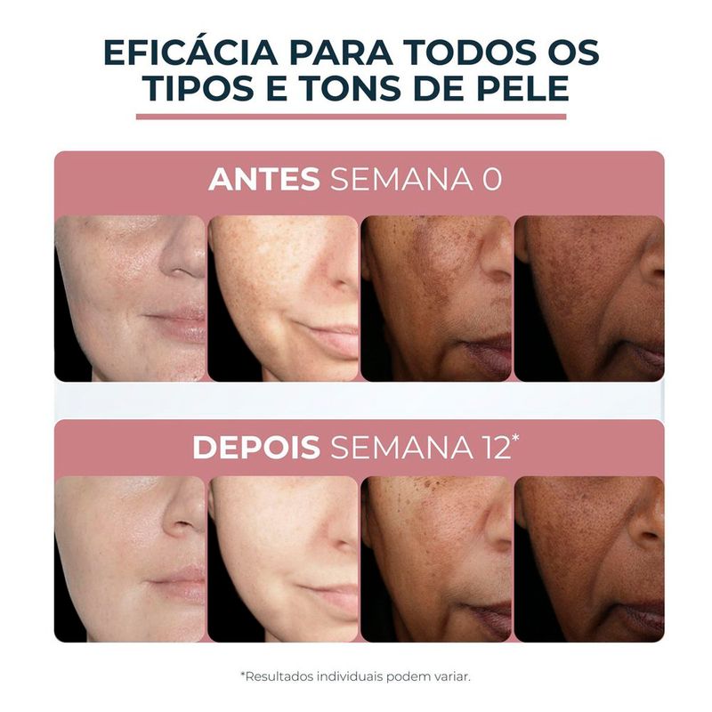 creme-facial-clareador-eucerin-anti-pigment-fps-30-50-ml_5